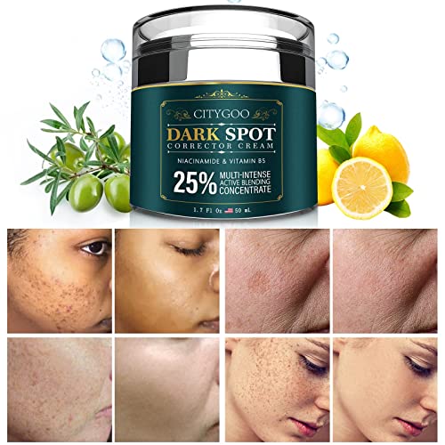 Dark Spot Remover for Face Dark Spot Corrector Cream - CITYGOO Official Imagery - 1