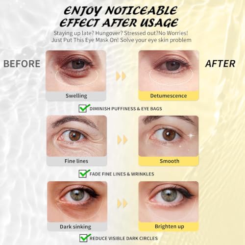 Maskiss Under Eye Patches (25 Pairs), Caffeine Eye Masks for - Product Imagery
