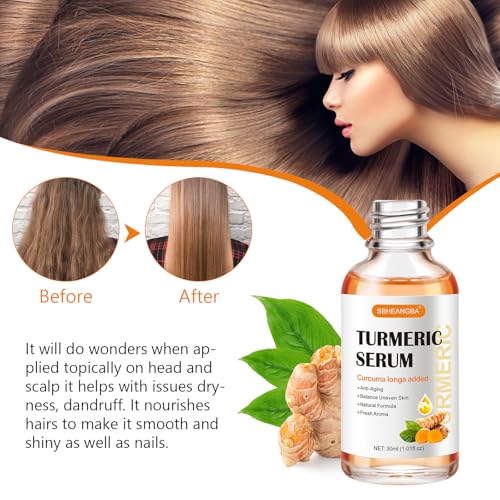 Turmeric Serum for Dark Spots，2 PCS Face Serum Turmeric Dark - Product Imagery
