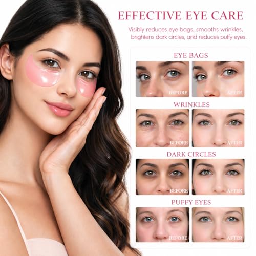 Under Eye Mask, Rose Under Eye Gel Pads With Collagen, Skincare - Product Imagery