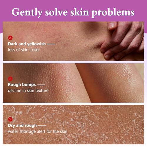 Glycolic Acid Body Scrub Stick for Rough & Bumpy Skin - 7% AHA + - Product Imagery