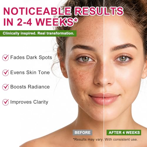 Arbutin 7% + Tranexamic Acid 4% Dark Spot Corrector Cream for - Product Imagery