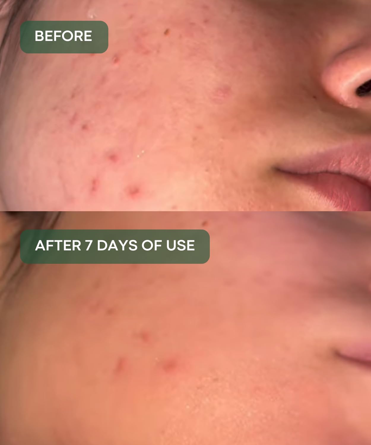 Rice Serum 87% with 10% Niacinamide – Korean Skincare for Pores, - erigeron