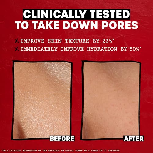 Thayers Alcohol-Free Witch Hazel Facial Mist Toner with Aloe - Product Imagery
