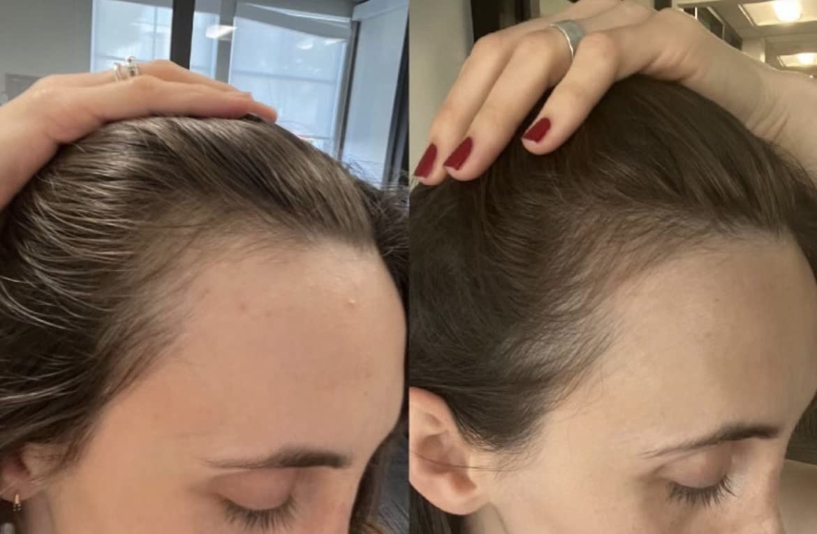 Bur Bur Growing Season Hair Growth And Repair Oil - With Burdock & Nettle Oil - Bur Bur Official Product View 8
