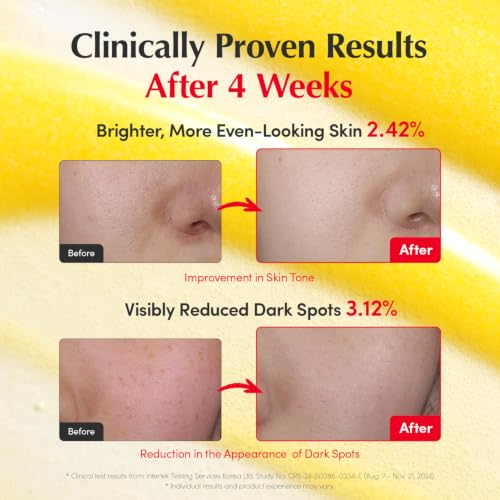 EQQUALBERRY Vitamin Illuminating Serum Triple Pack | Niacinami... - Product Imagery