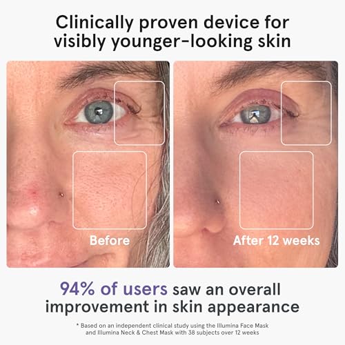 iRestore LED Face Mask for Youthful Skin, Red Light Therapy for - Product Imagery