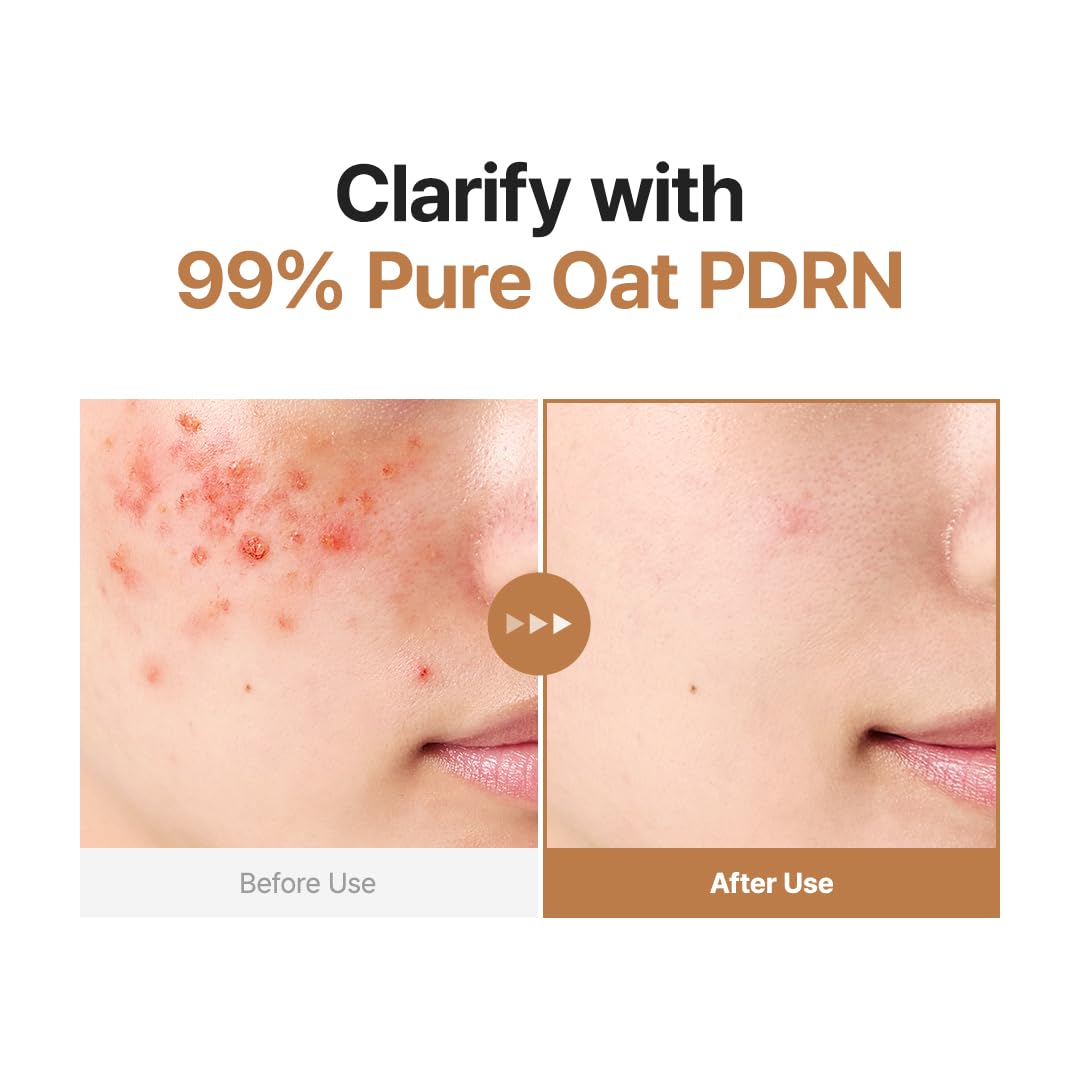 PURITO Oat PDRN Refining Toner for Sensitive Skin 6 76 fl oz - PURITO Official Imagery - 3