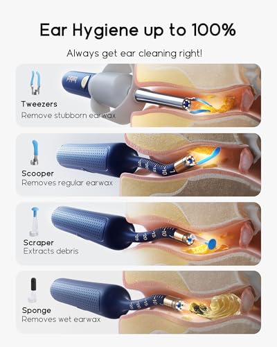 Bebird R37R Ear Wax Removal Tool Camera, Flexible Scope and - Product Imagery