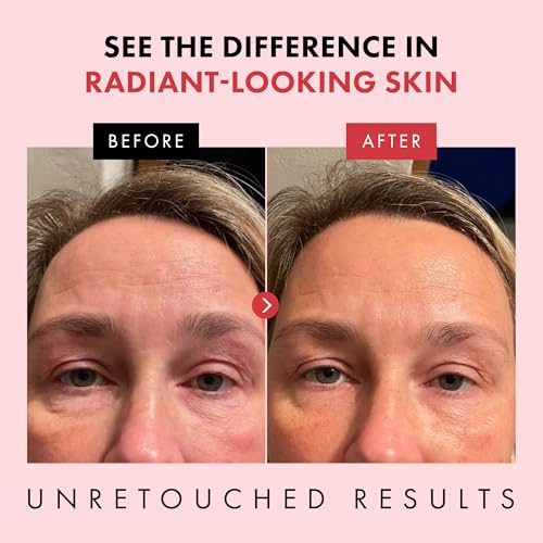 Eclat Skincare Retinol Night Cream – Renewing Retinol Cream for - Product Imagery