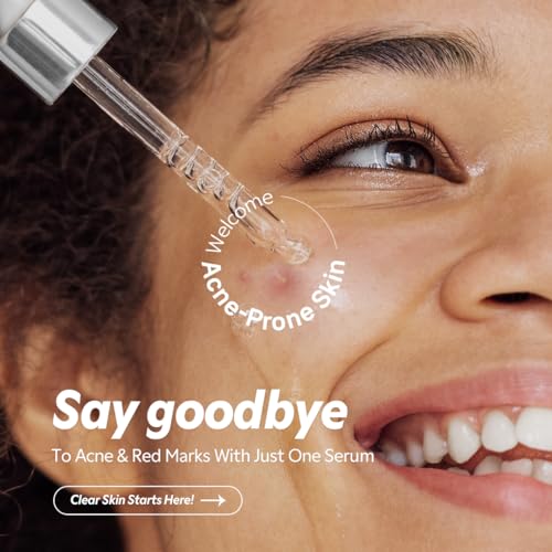 TIRTIR Azelaic Acid 12% Serum for Blemish-Prone Skin - Lightwe... - Product Imagery