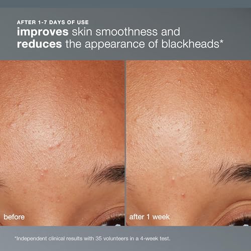 Dermalogica Daily Microfoliant, Brightening Face Exfoliator - Product Imagery