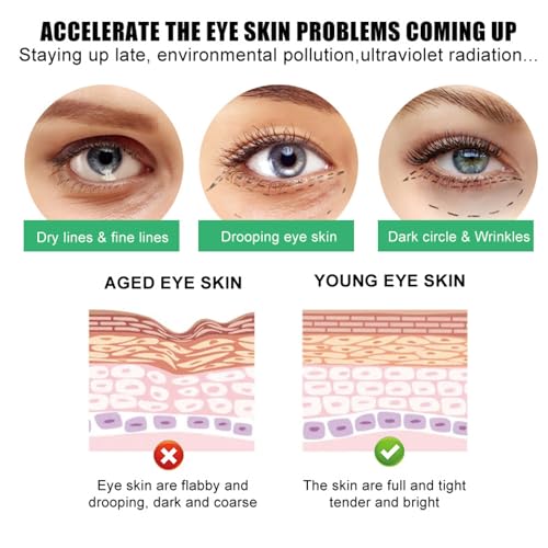 SORYA Caffeine Eye Cream for Dark Circles & Puffiness - Product Imagery