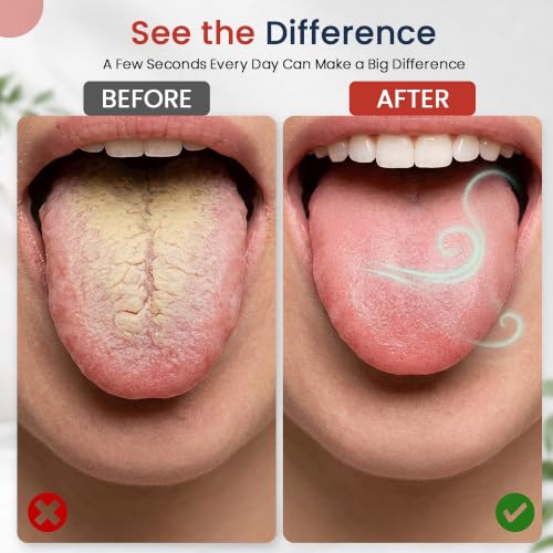 Tongue Scraper Cleaner (2 Pcs) Best Stainless Steel Tongue - Product Imagery
