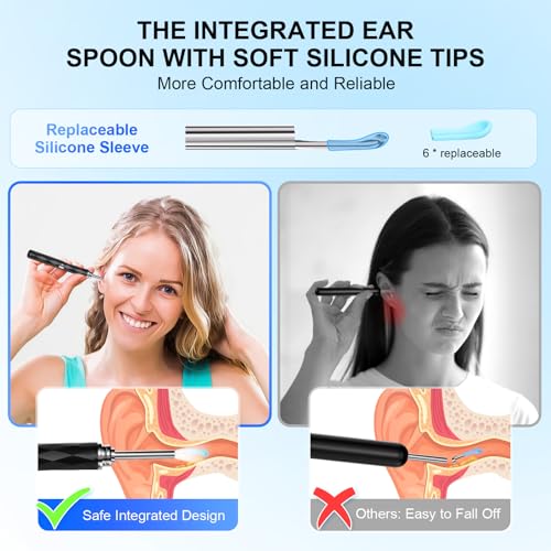 High-Definition Ear Wax Removal, Wireless Ear Cleaner, Safe and - Product Imagery