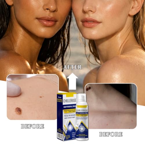Chill Erase Bump Renewal, 120 ml Soothing And Cooling Formula, - Product Imagery