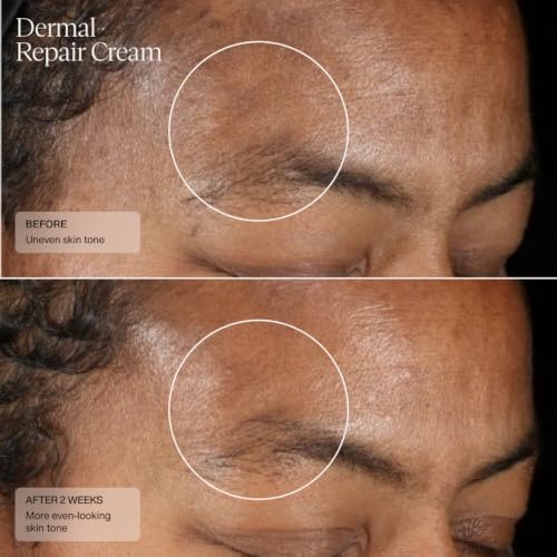 Senté Dermal Repair Facial Cream | Nourishing for Rosacea, - Product Imagery