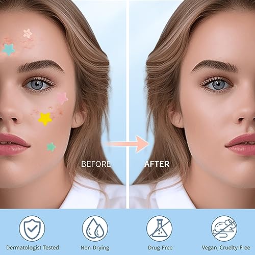 Pimple Patches for Face, Hydrocolloid Acne Patches, Cute Star - Product Imagery