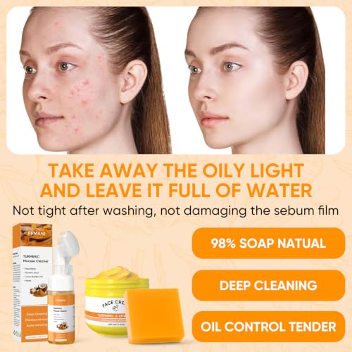 Turmeric Skin Care Set: Turmeric Soap Bar Turmeric Face Wash and - Product Imagery