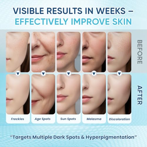 Dark Spot Remover for Face Body Serum with Hyperpigmentation - Product Imagery