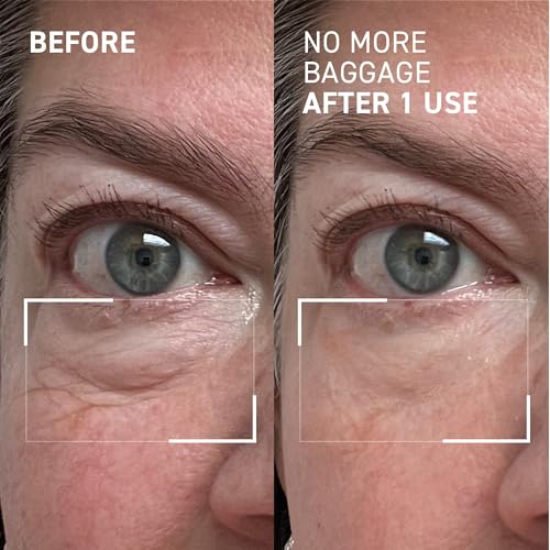 Dr. Brandt Needles No More, No More Baggage - Minimizes - Product Imagery