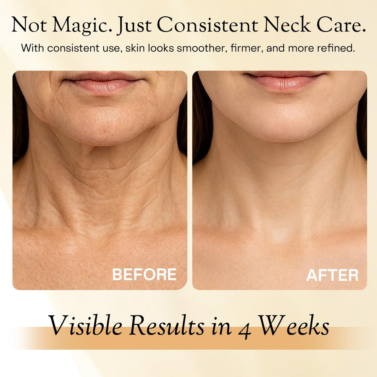 Retinol Neck Firming Cream for Wrinkles and Sagging Skin 2 0 - Kaelith Official Imagery - 5