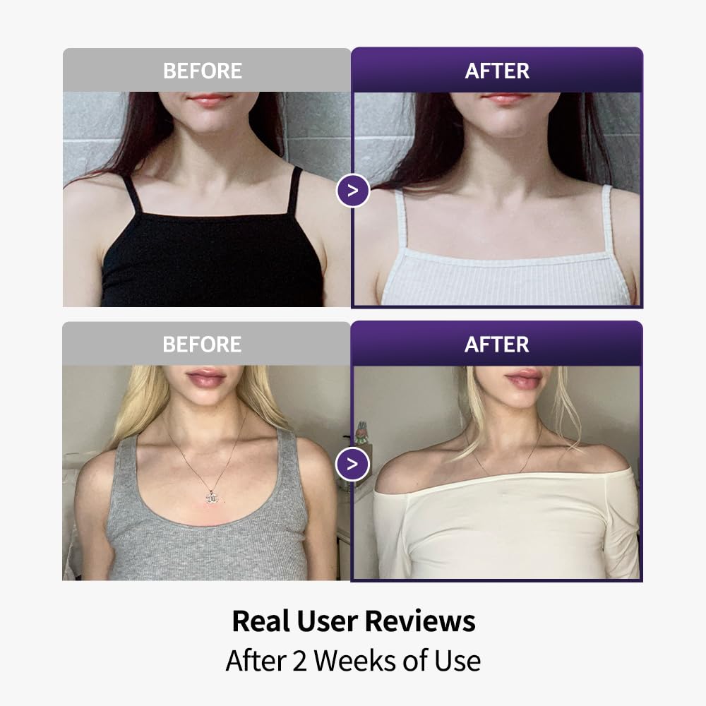 SLLIGHT Trapezius Patch | K-Beauty Neck & Shoulder Relief