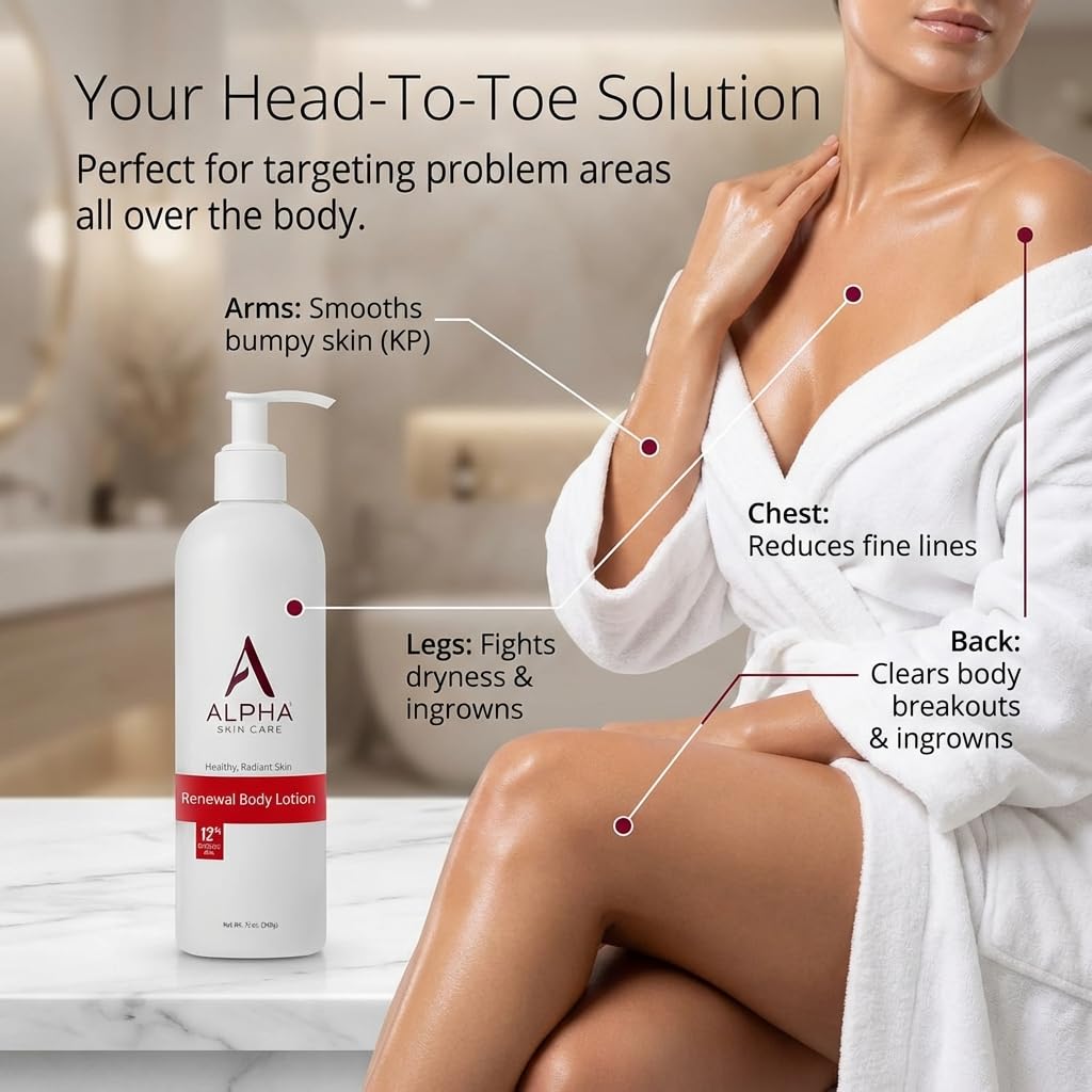 Alpha Skin Care Revitalizing Body Lotion, 12% Glycolic AHA, 12 Oz - Alpha