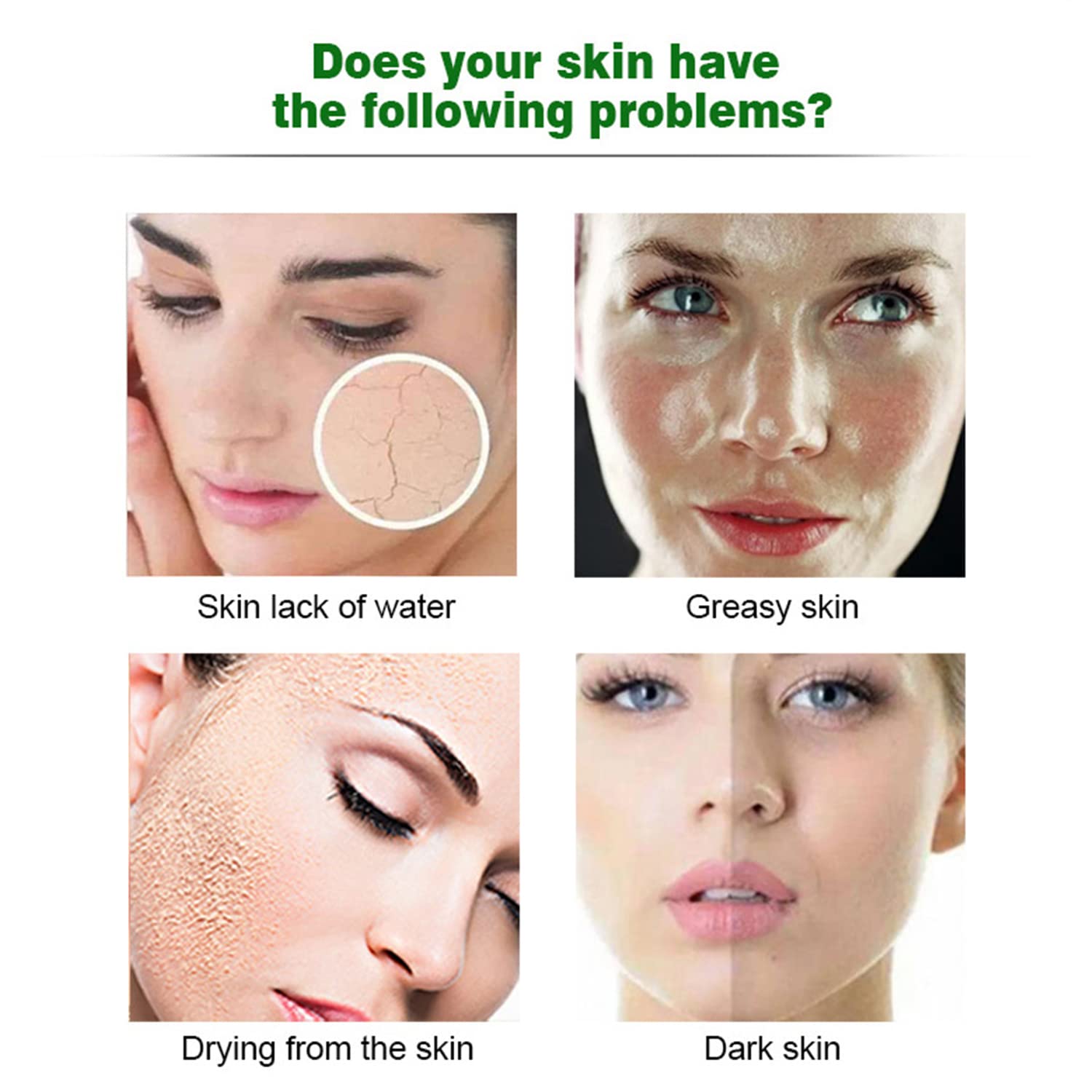 AICHUN BEAUTY Facial Mask Essence Anti-Acne Refresh 10pcs - AICHUN BEAUTY