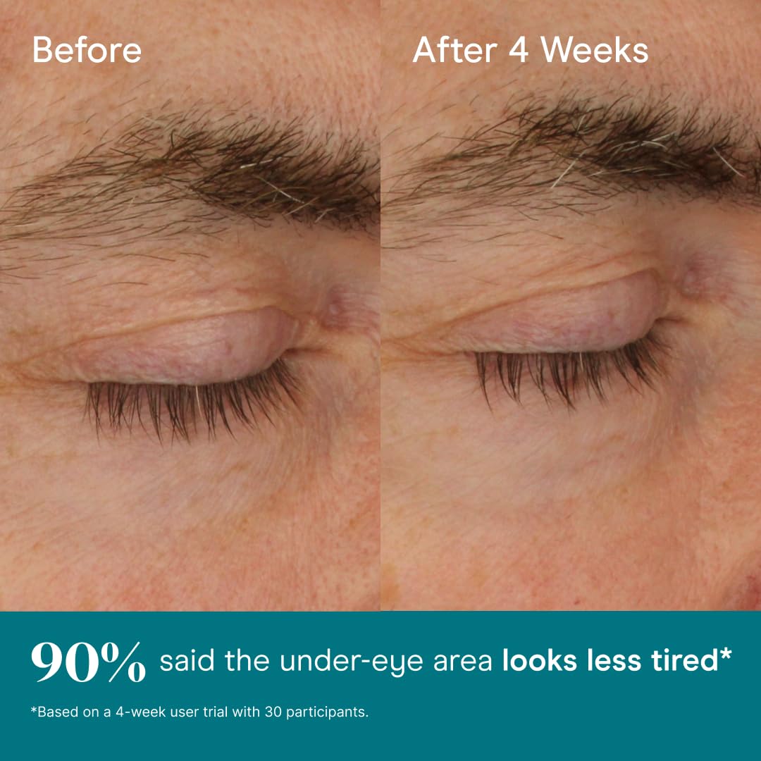 Baebody Cooling Under Eye Gel for Dark Circles and Puffiness - Baebody Official Imagery - 7