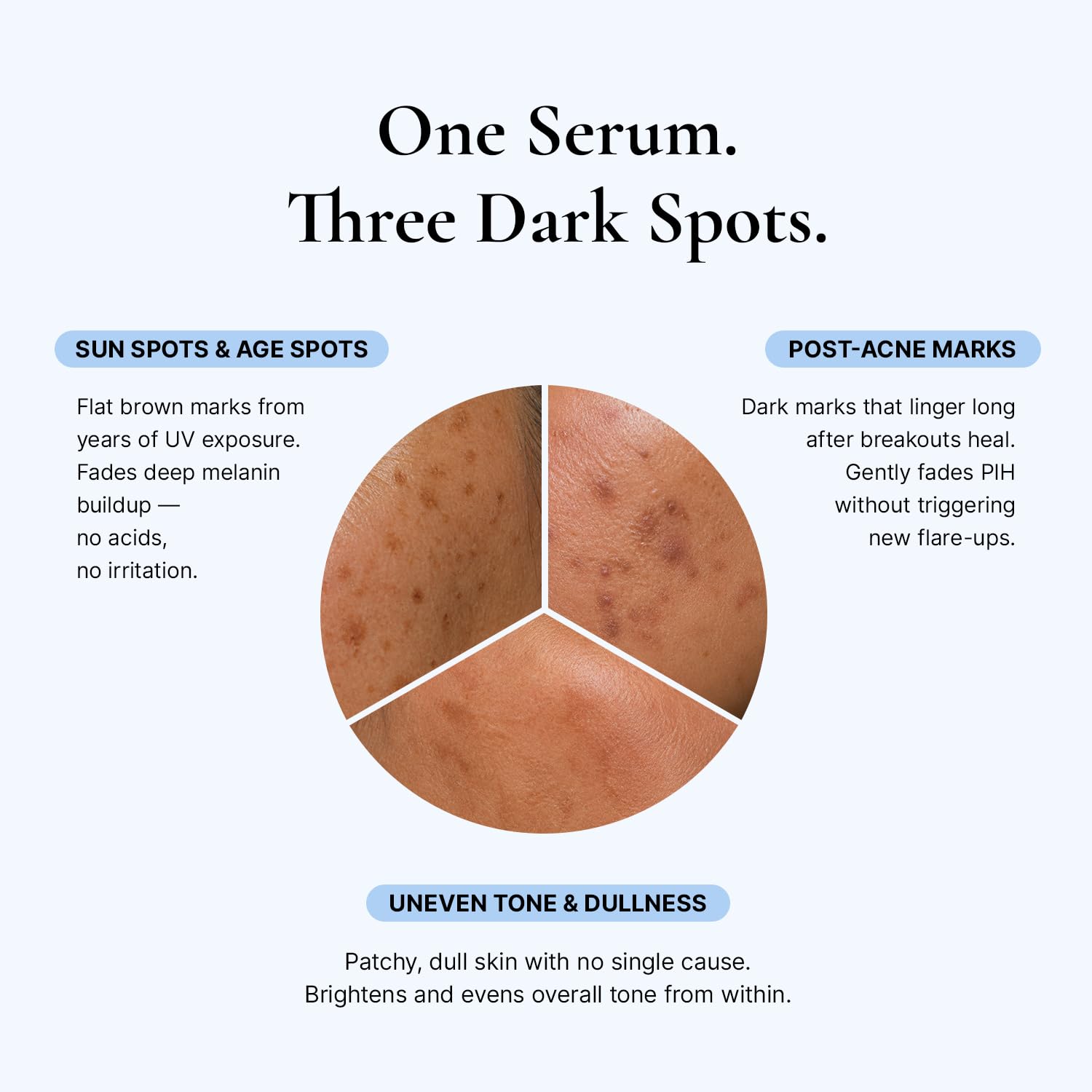 EnaSkin Dark Spot Corrector 5% Tranexamic Acid Serum