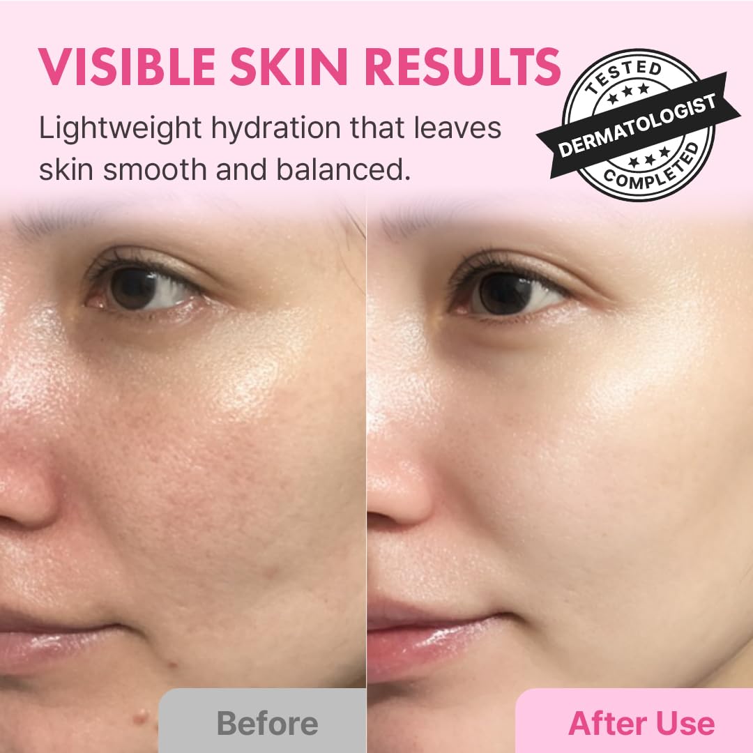 Hanskin Hyaluron Skin Essence, Hyaluronic Acid Toner, Dry Skin, - Hanskin