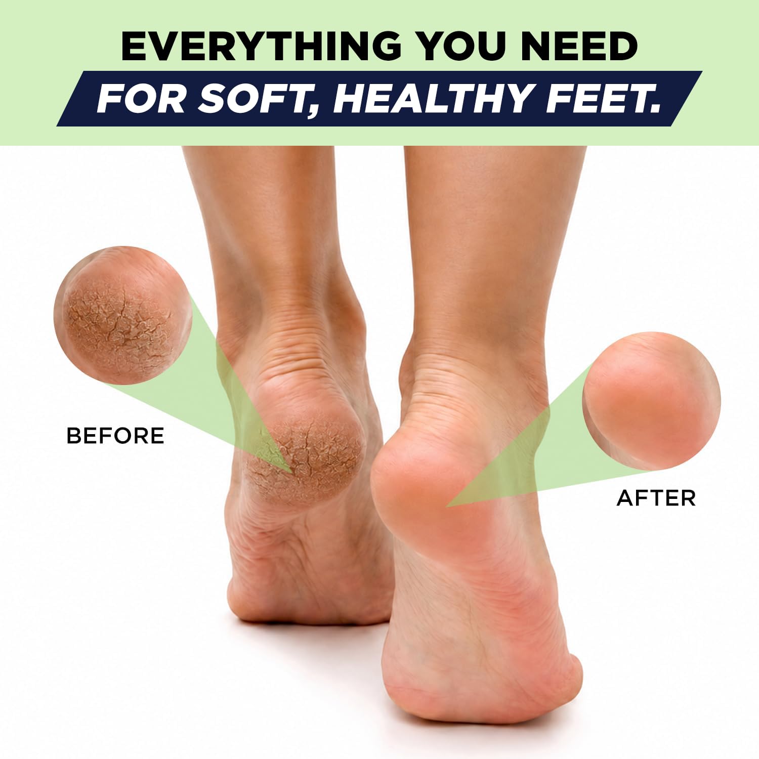 FOOT CURE Tea Tree Oil Foot Balm for Dry Cracked Heels