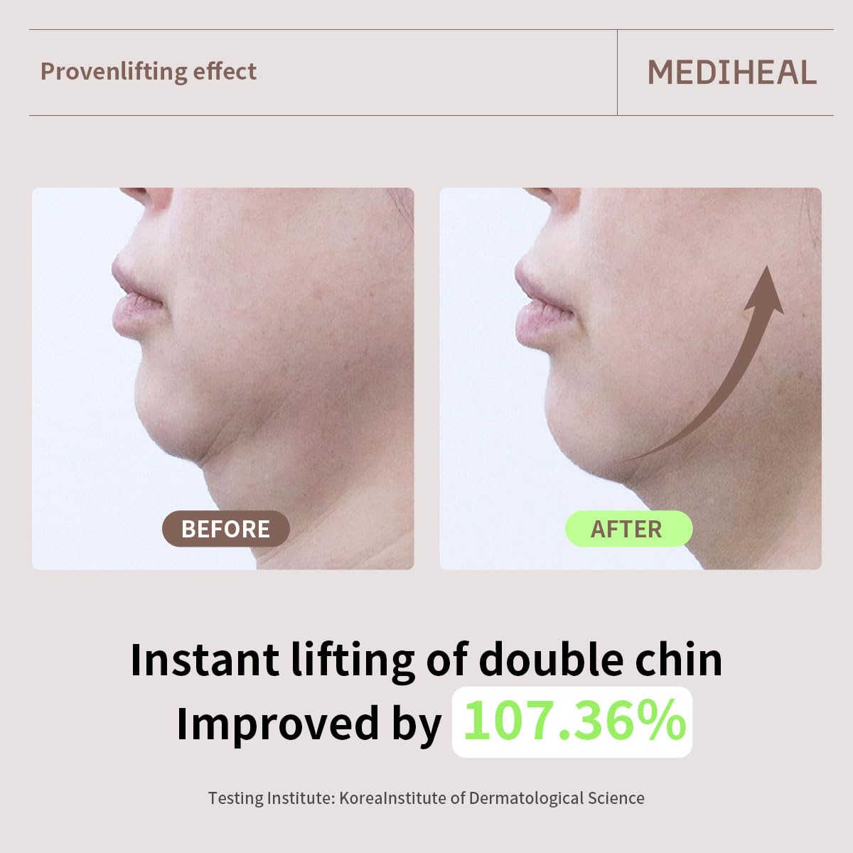 MEDIHEAL Retinol Collagen Cream Lifting Mask (4 Counts) - MEDIHEAL Official Product View 7