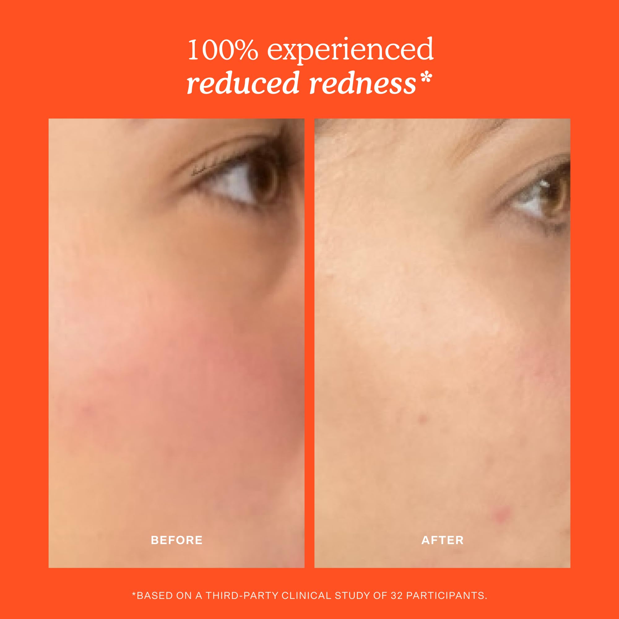 Tower 28 SOS Recovery Hydrating Face Cream for Sensitive - Tower 28 Official Imagery - 6