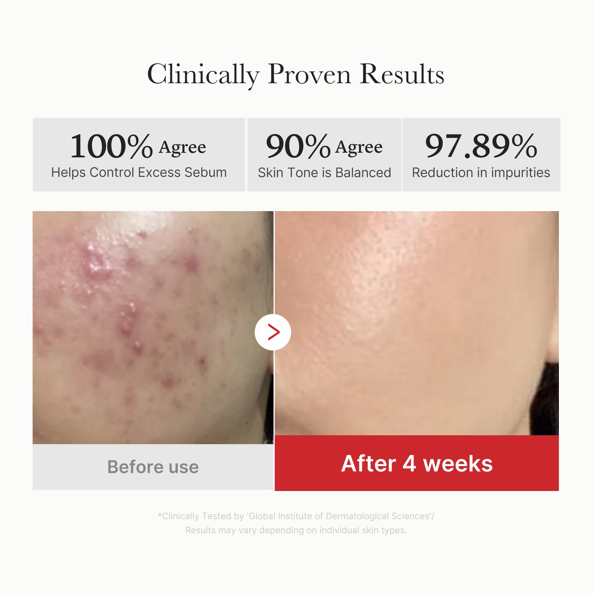 medicube Clarifying Pad & Soothing Cream Duo - medicube Official Product View 4