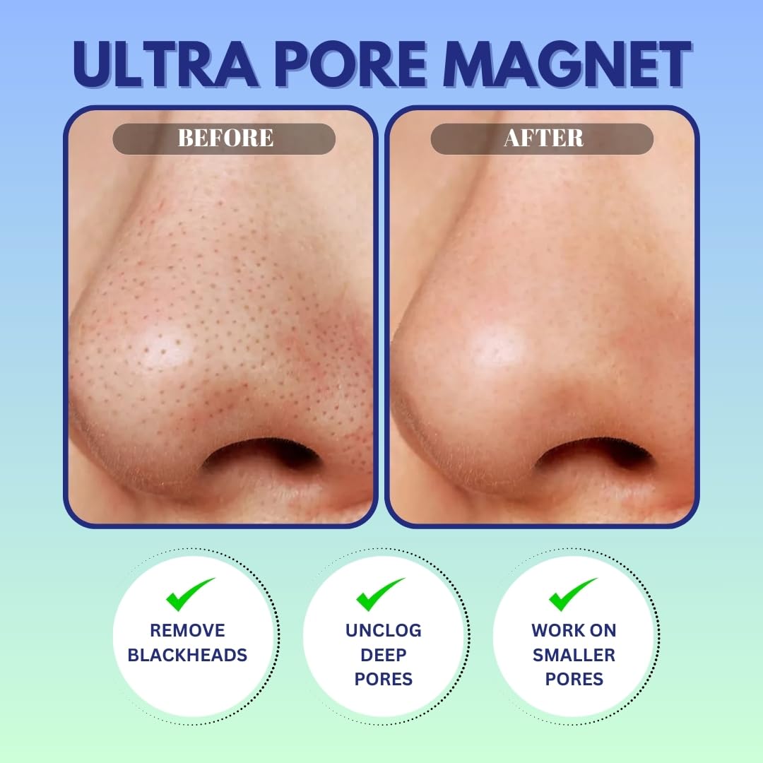 GENDA Blackhead Remover Nose Pore Strips for Deep Cleansing, - GENDA