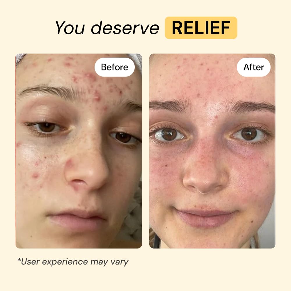 Thyme Tea Tree Flare Care - MyMagicHealer Official Imagery - 4