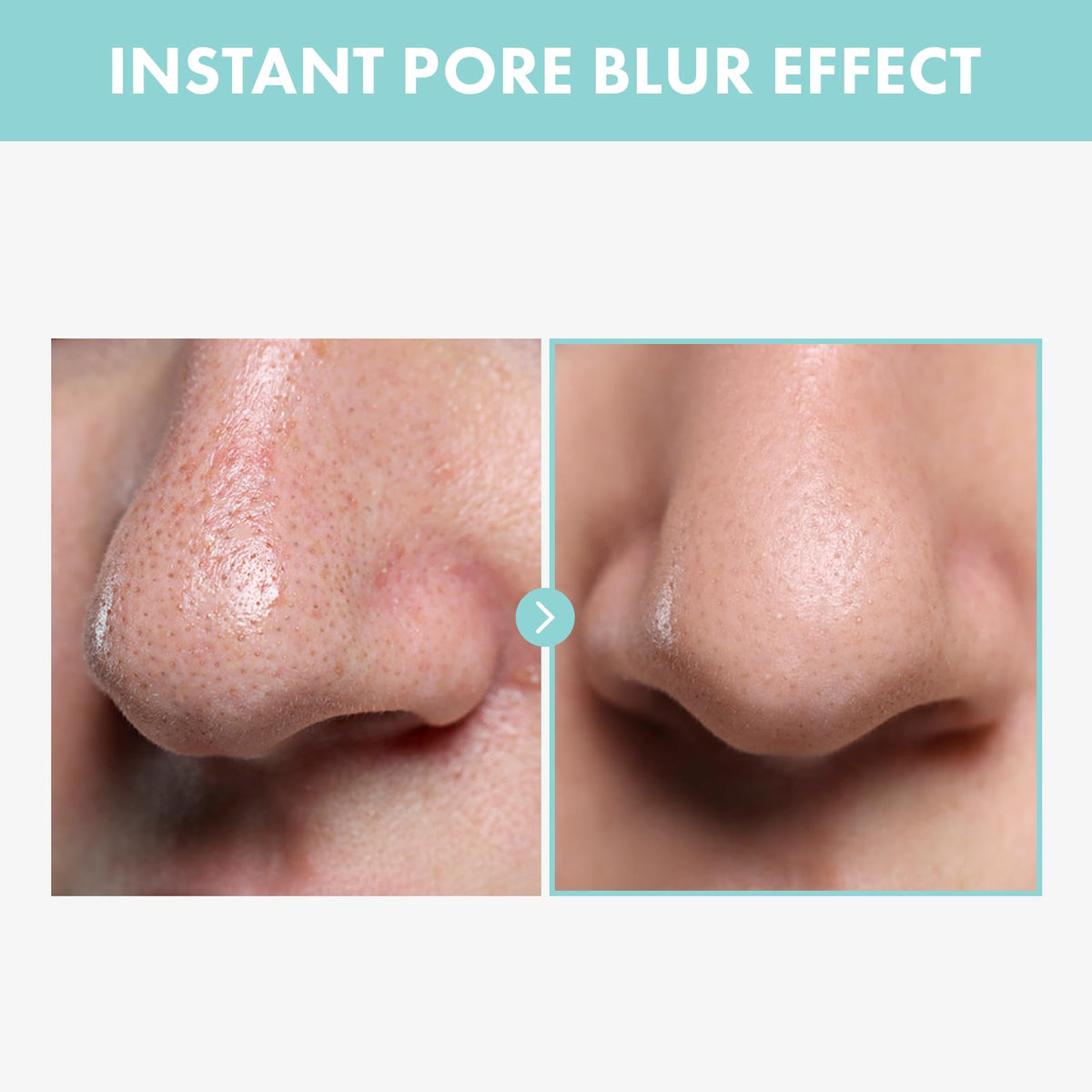 TOSOWOONG Pore Tightening Serum Pore Minimizer for Face - TOSOWOONG Official Imagery - 4
