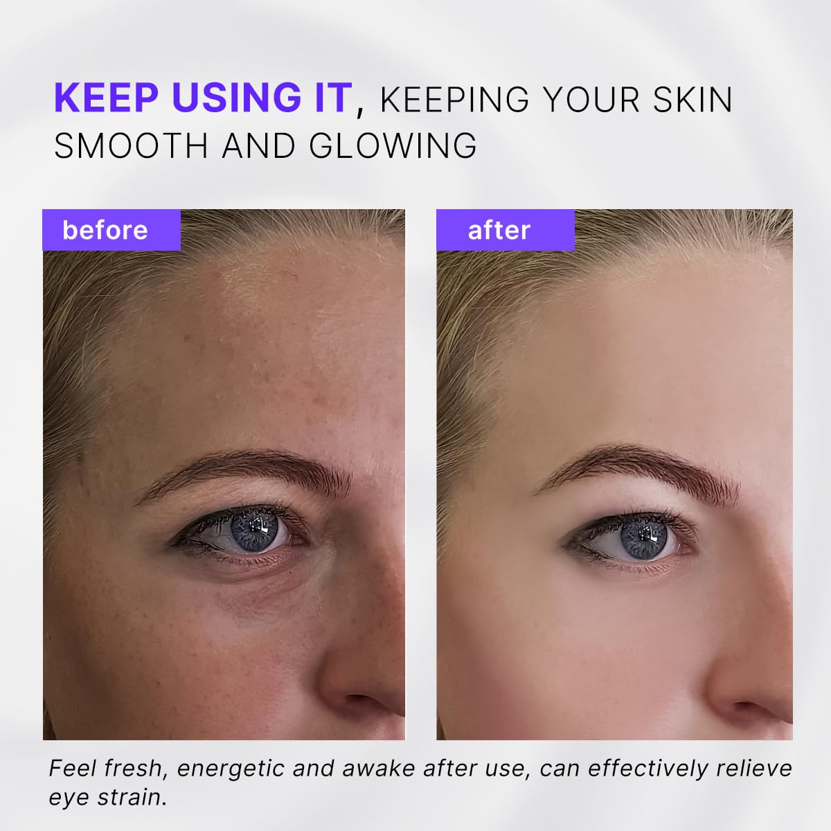 QooWo Eye Roller, Facial Roller Massager - Reduces Puffiness & Dark Circles & Coo - QooWo Official Product View 5
