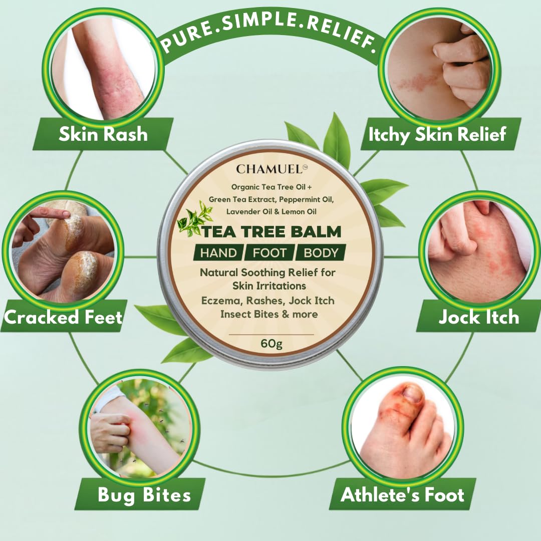 Chamuel Tea Tree Oil Balm – Itchy Skin Relief