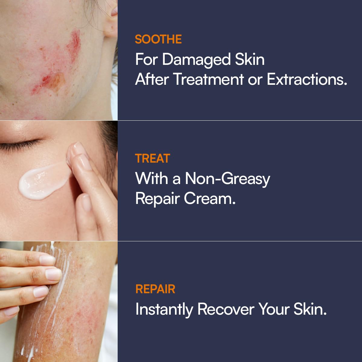 Abso BIO BAND REPAIR Cream Daily Post Treatment Skin Barrier - Abso. Official Imagery - 5