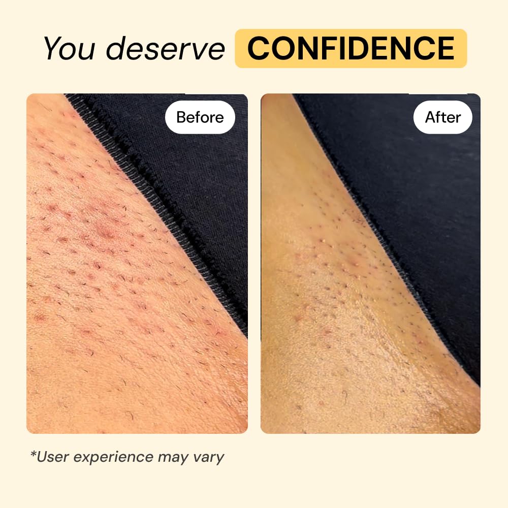 Thyme Tea Tree Flare Care - MyMagicHealer Official Imagery - 6