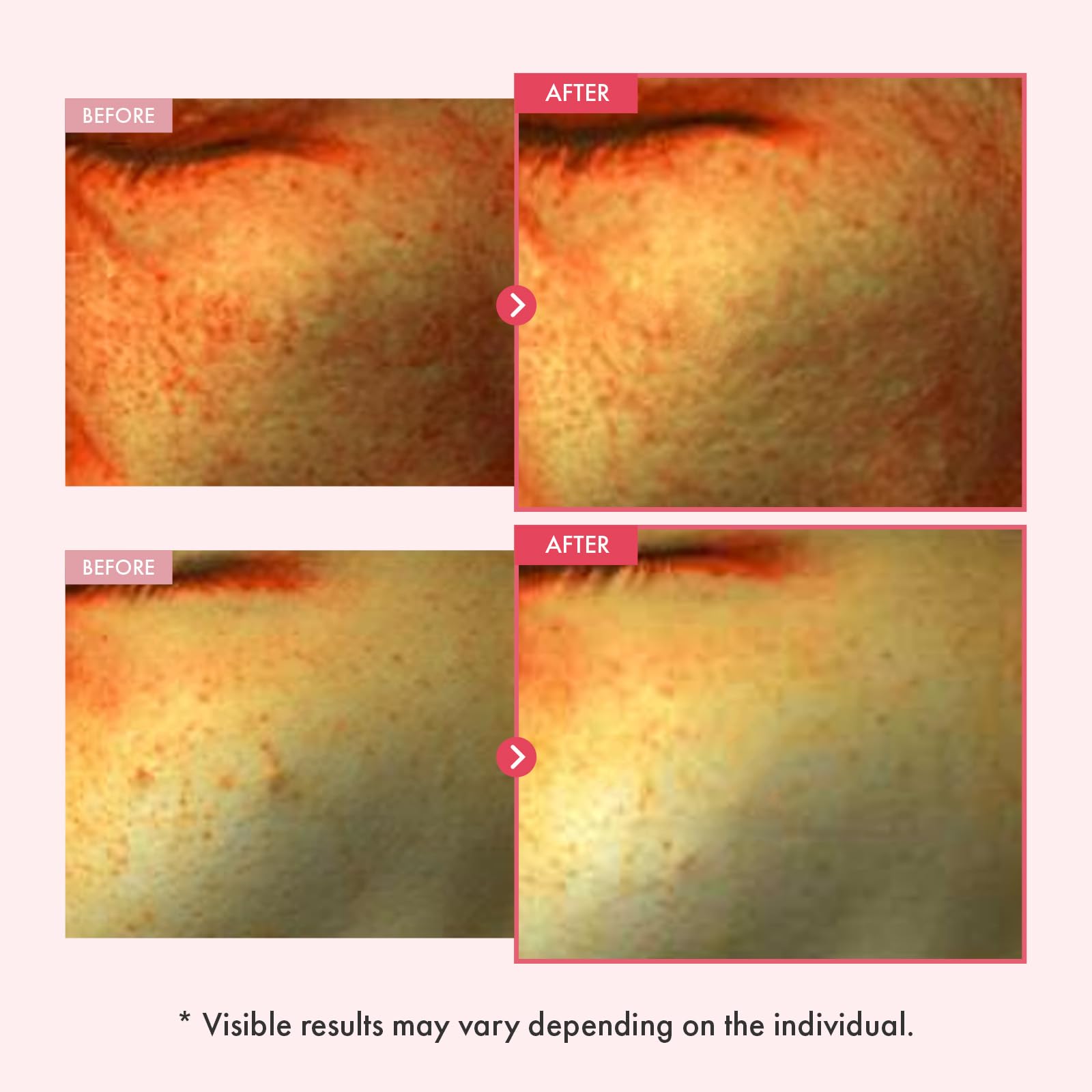 TOSOWOONG Niacinamide 10% + Arbutin 7% Serum for Dark Spots - TOSOWOONG