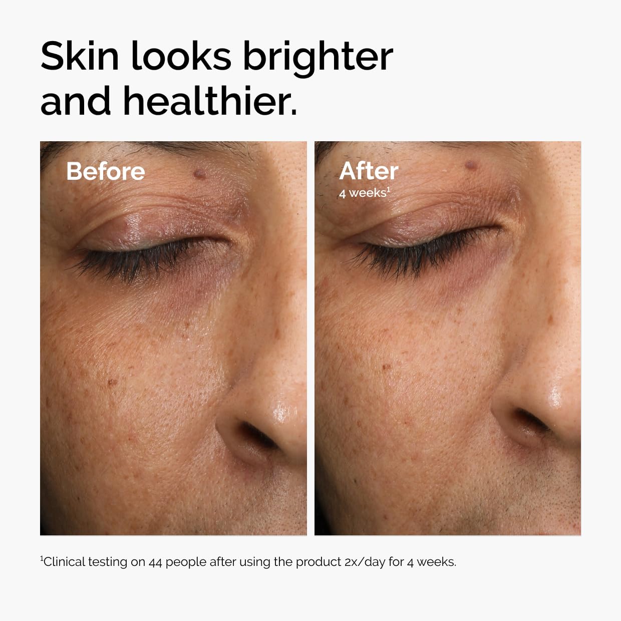 Elefair Tech The Ordinary Multi - Antioxidant Radiance Serum & Vitamin C - Elefair Tech Official Product View 5