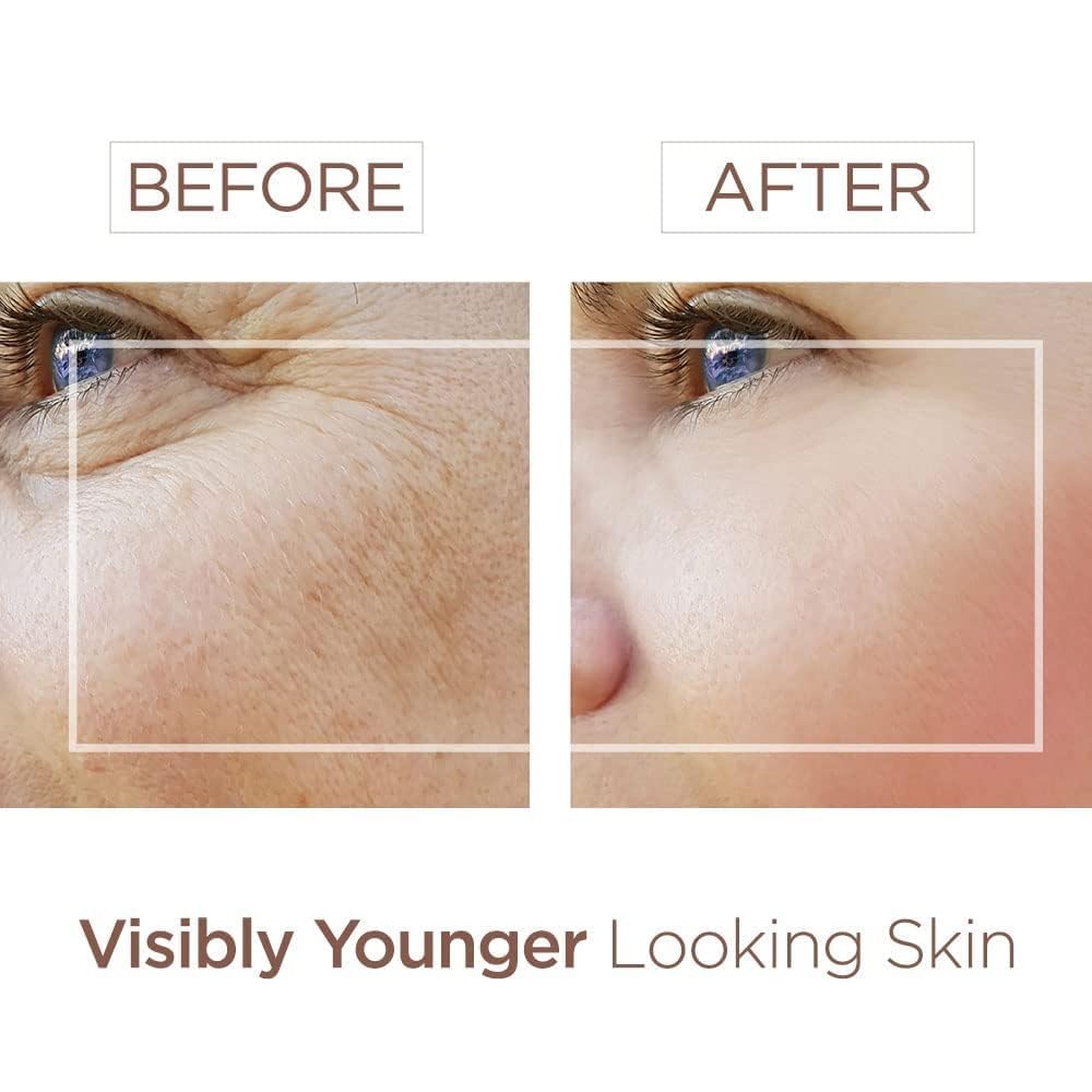 BEE and YOU Moisturizing Anti Aging Face Serum, Radiance &amp; - BEE &amp; YOU