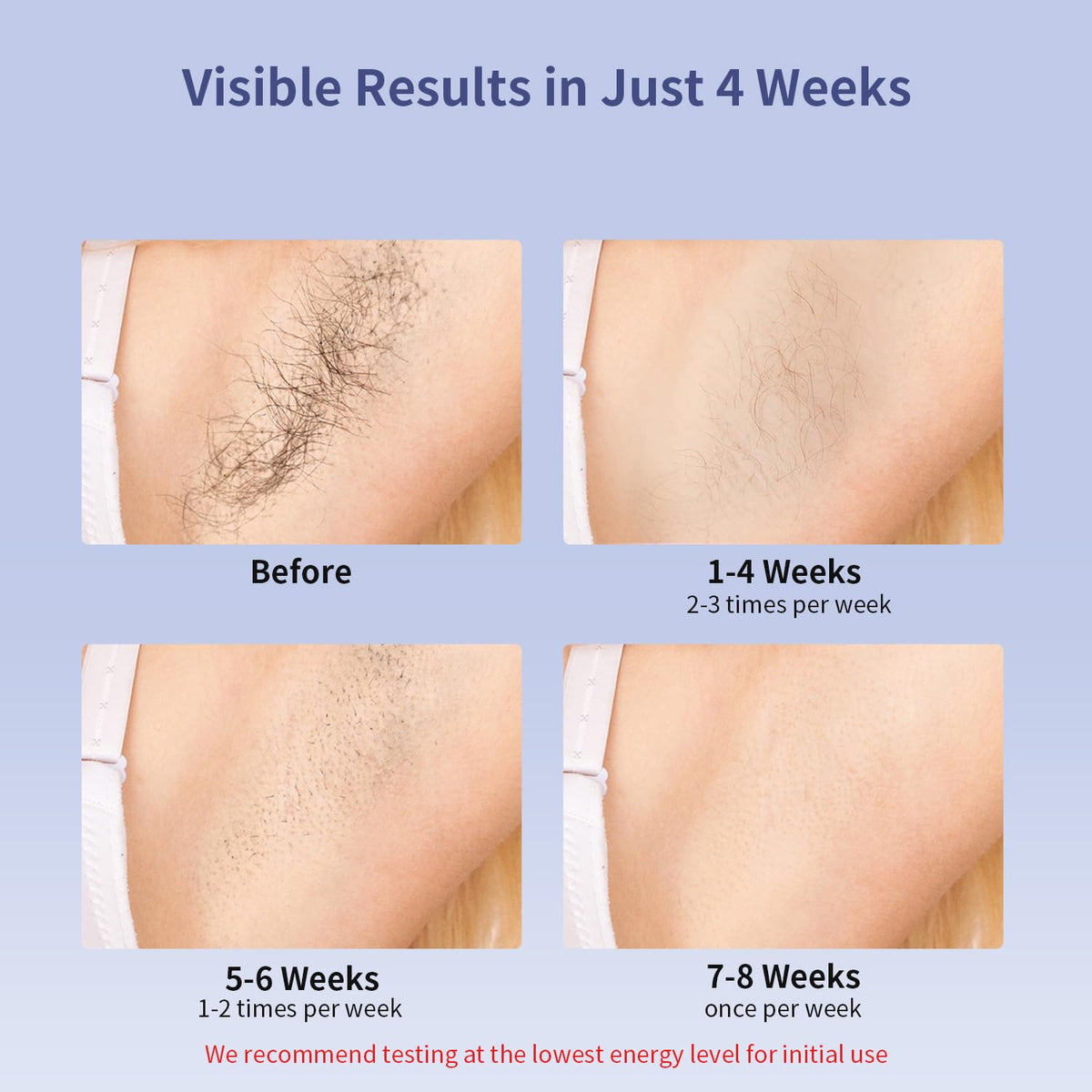 MLAY IPL Laser Hair Removal Ice Cooling Hair Removal Device - MLAY Official Imagery - 5