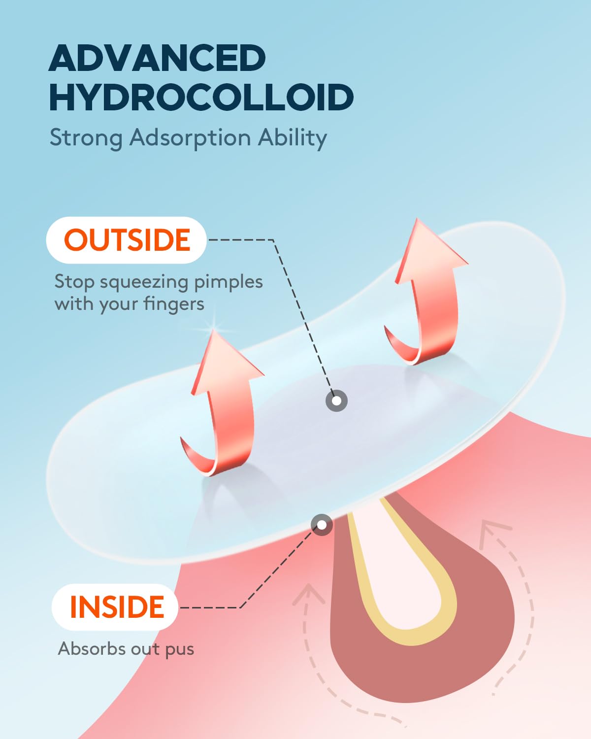 Acne Pimple Patch FSA Eligible Invisible Hydrocolloid Acne - ZATKTK Official Imagery - 4