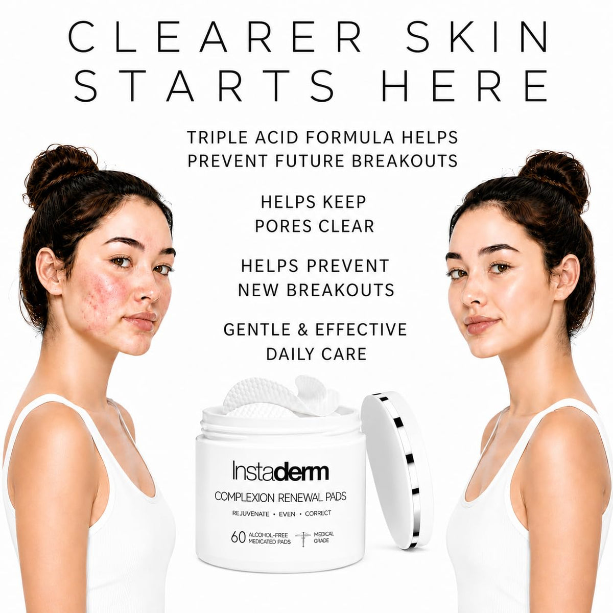 Acne Treatment Pads with Salicylic Glycolic Lactic Acid - Instaderm Official Imagery - 7