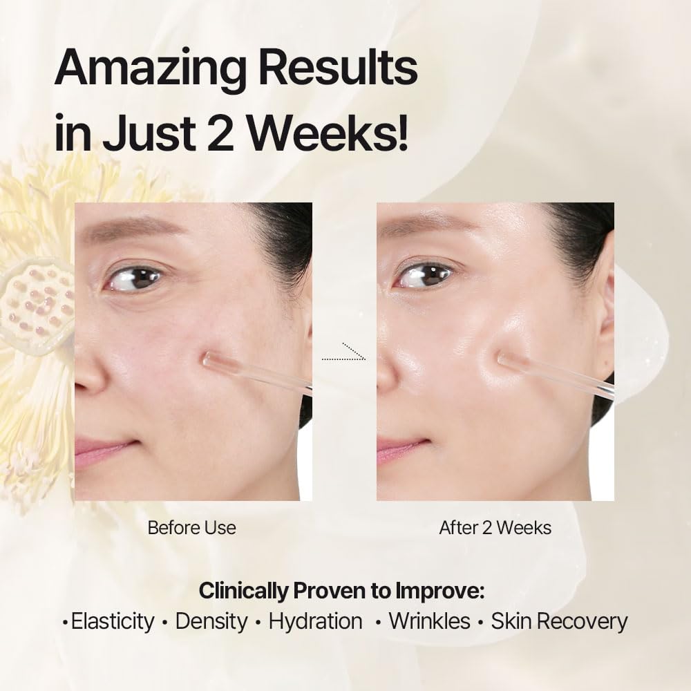 THEPURELOTUS Best Duo for Skincare: Korean Probiotic Serum &amp; - THE LOTUS PURE JEJU ISLAND